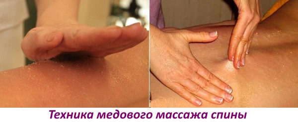 Техника массажа